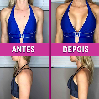 Outra comparação antes e depois com resultados de firmeza e volume